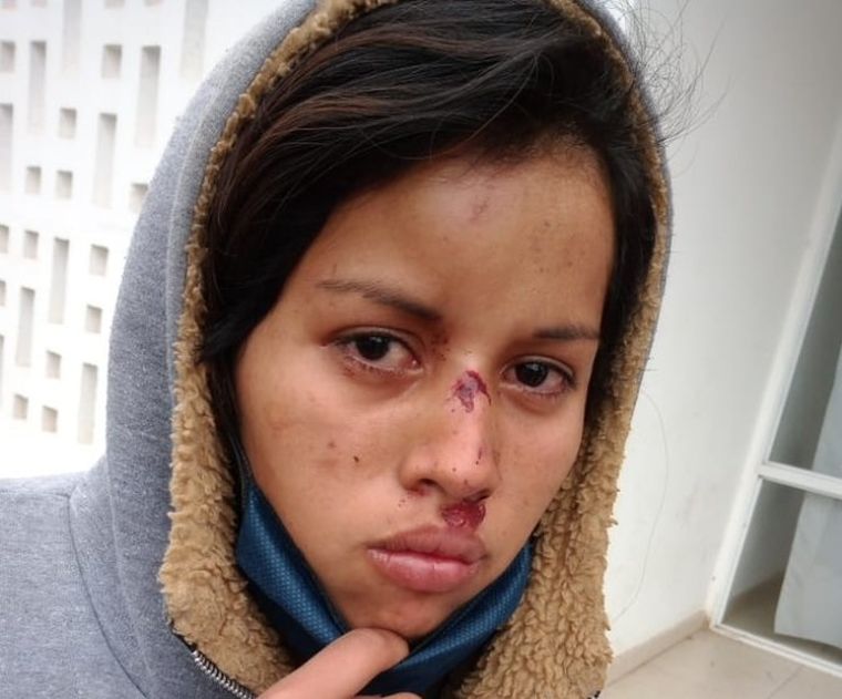 Una de las jóvenes Qom golpeadas por la policía en Chaco