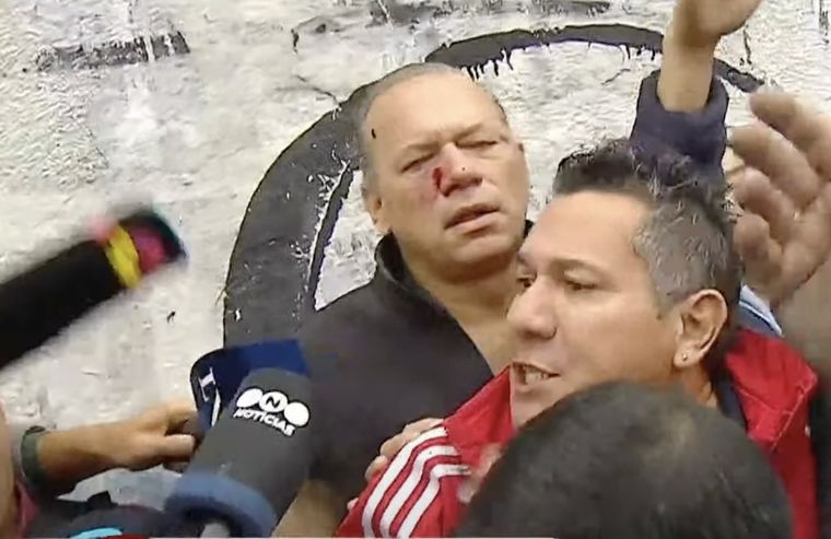 Así quedó Sergio Berni Foto: Captura de TN