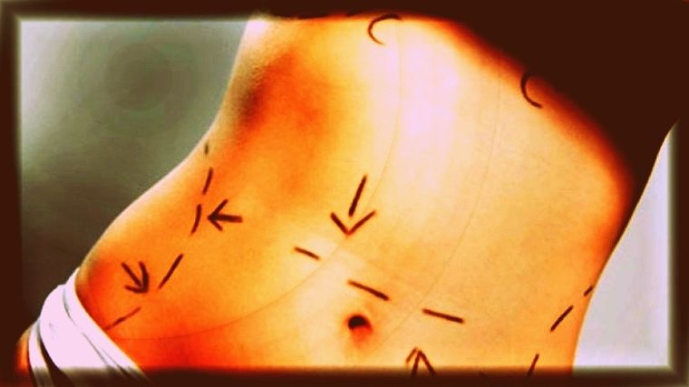 Foto: Gentileza Infobae.com