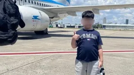 El niño ya fue sometido a dos cirugías. El niño ya fue sometido a dos cirugías.