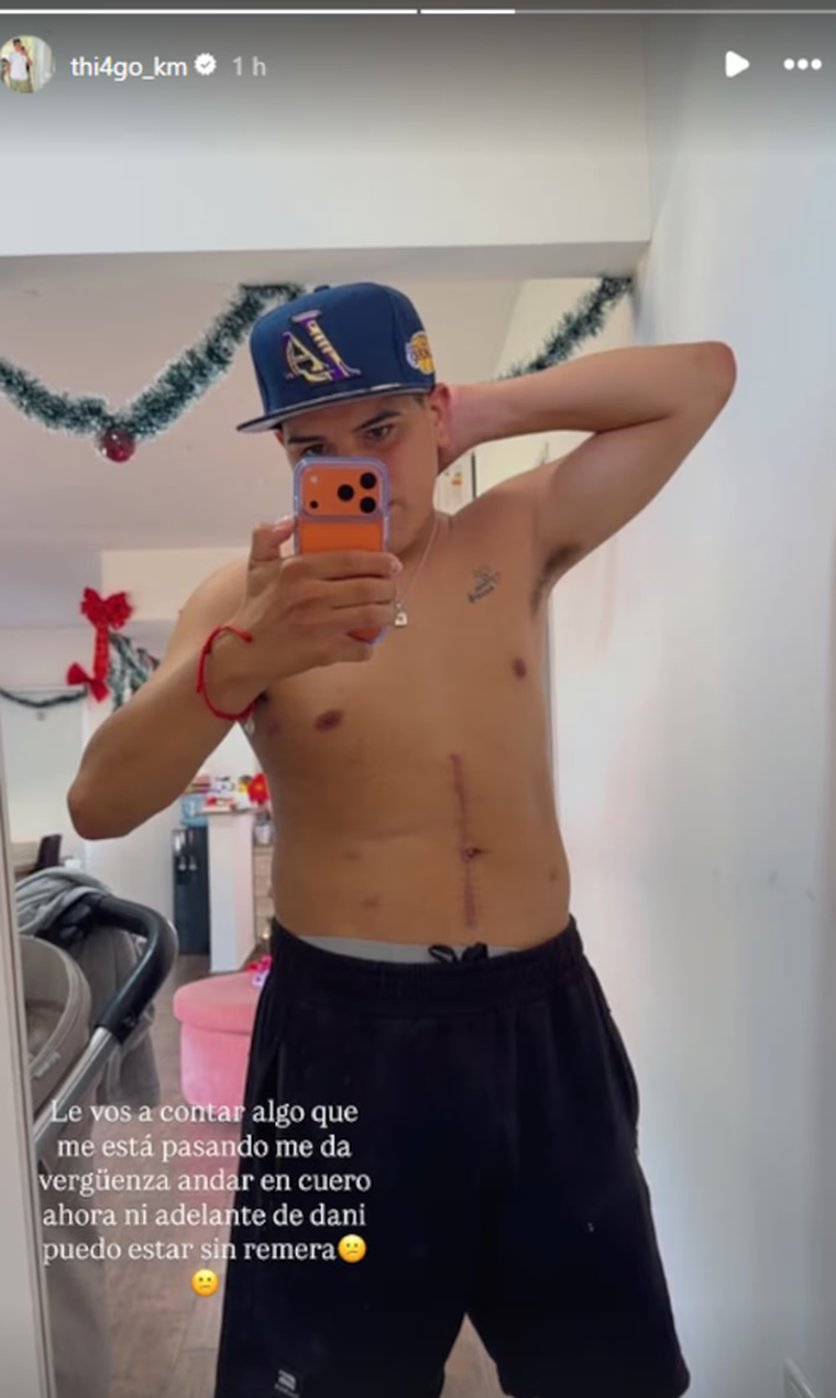 Thiago Medina mostró sus cicatrices. Thiago Medina mostró sus cicatrices. 