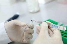 Señalan que hay menos casos de dengue Foto: Universidad de La Plata