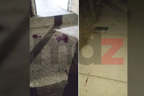 Las manchas de sangre tras los disparos que recibió la víctima durante el asalto en su casa de La Favorita.&nbsp;