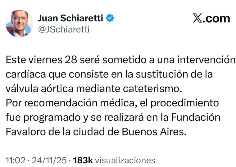 El exmandatario cordobés, Juan Schiaretti, será sometido a una intervención cardíaca. El exmandatario cordobés, Juan Schiaretti, será sometido a una intervención cardíaca.