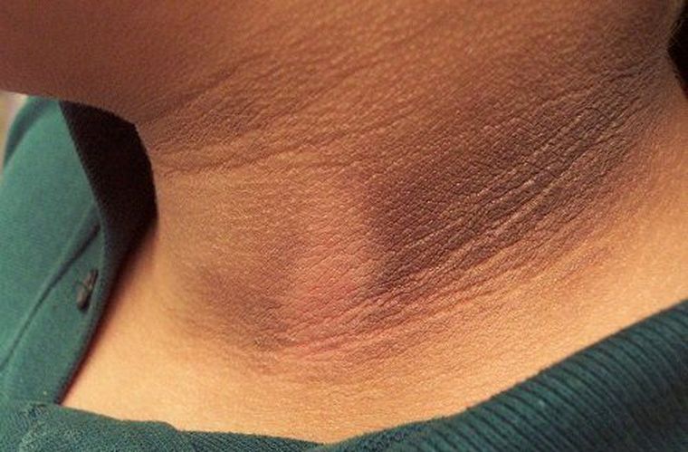 Este síntoma no puede pasar desapercibido. Este síntoma no puede pasar desapercibido.