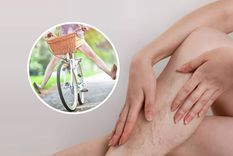 Los ejercicios diarios son clave para prevenir várices en adultos mayores.