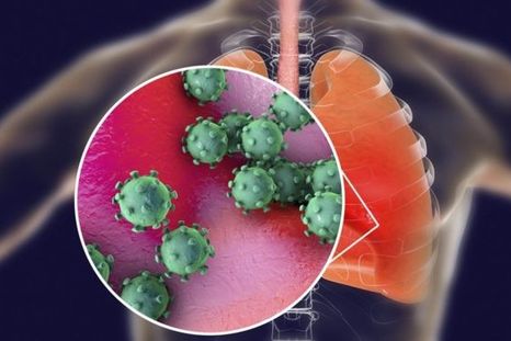 El coronavirus puede causar lesiones severas en los pulmones.