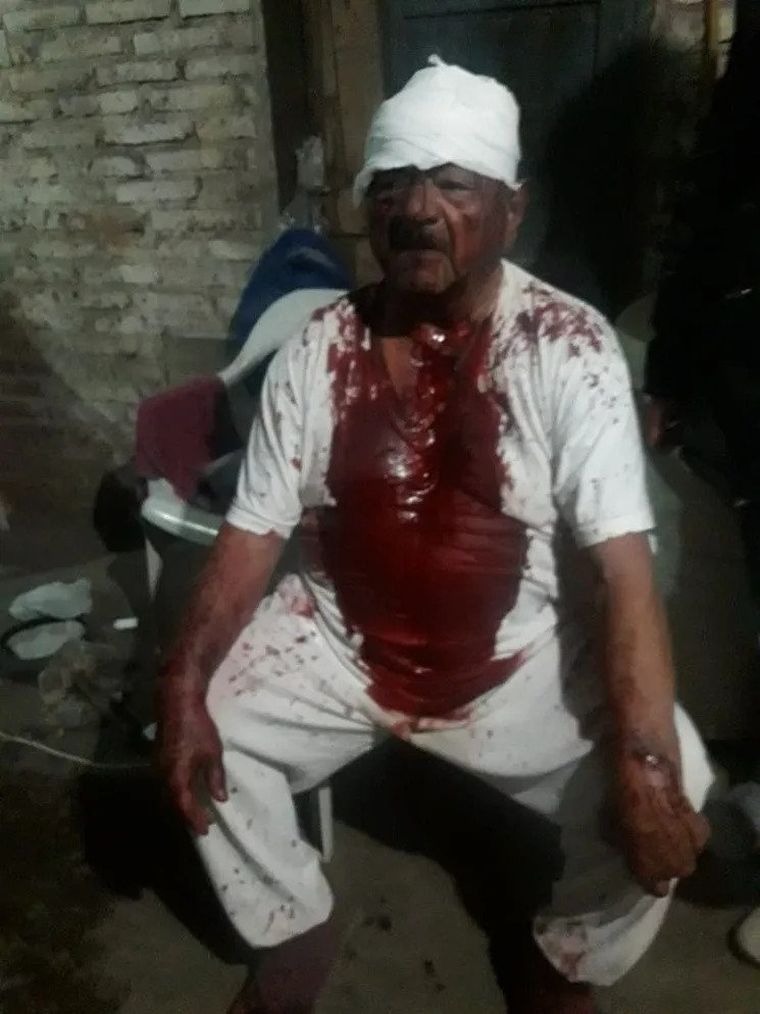 El jubilado terminó con graves heridas en la cabeza y en sus brazos