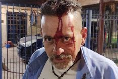 paran tres lineas de colectivos por otro violento ataque a un chofer