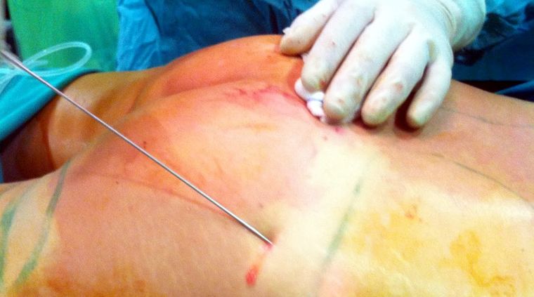 Foto: Publicada en 2.bp.blogspot.com