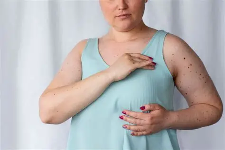 El cáncer de mama continúa siendo el más frecuente entre las mujeres de todo el mundo. El cáncer de mama continúa siendo el más frecuente entre las mujeres de todo el mundo.