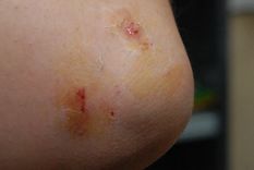 Foto: Pablo Matar/Mediamza.com