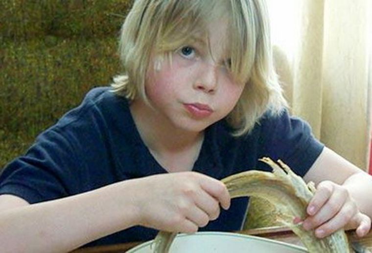 El pequeño que hace marketing de su rareza. Foto: El Tiempo