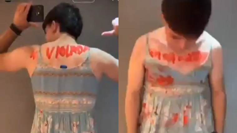 El estudiante fue criticado por la desafortunada elección del disfraz.