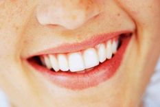 El truco definitivo para blanquear tus dientes con un ingrediente de la despensa Hoy traemos un método natural que ayuda con la salud de tu boca. Foto: Freepik