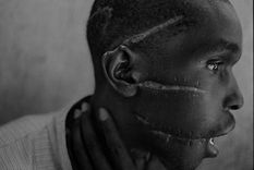 el dolor de la guerra en el ojo de james nachtwey