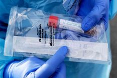 con fondos del mercosur, argentina comprara 45 mil tests para detectar el virus