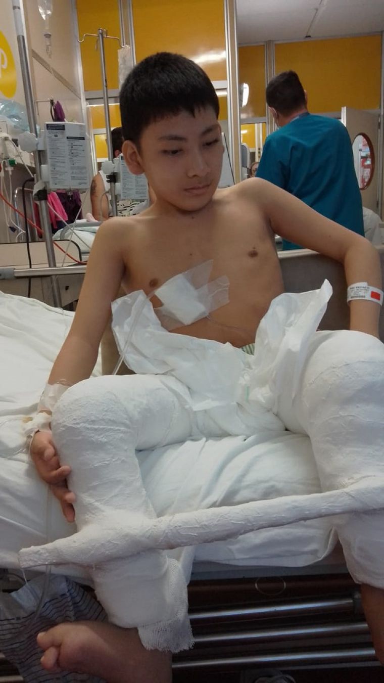 Renzo Nuñez fue operado esta mañana en el Garrahan. Necesita de una silla de ruedas especial Foto: Gentileza
