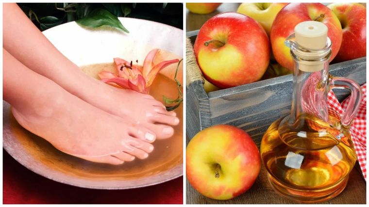 Vinagre de manzana y bicarbonato de sodio, dos elementos que frenan la formación de hongos y bacterias en los pies. Foto: Mejor con salud (mejorconsalud.as.com)