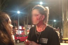 La joven tras ser herida