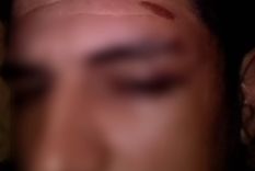 Golpeado Fernando dice que le duele hasta el pelo. Se despertó y no recuerda nada.