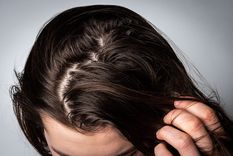 6 trucos para controlar el cabello graso sin ir a la peluquería Te explicamos cómo identificar si tienes este tipo de cabello. Foto: Pexels 6 trucos para controlar el cabello graso sin ir a la peluquería Te explicamos cómo identificar si tienes este tipo de cabello. Foto: Pexels