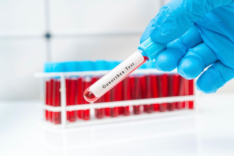 Más diagnósticos equivalen a más casos, según el ECDC, aunque esto no explicaría por sí solo el aumento de infecciones.