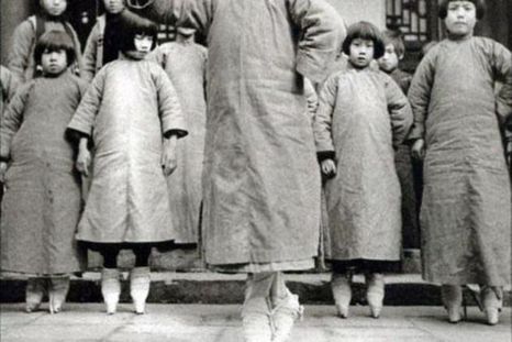 Conocé la extraña y dolorosa costumbre del vendado de pies en China