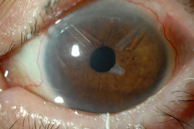 MDZol | Iconografía Ojo Izquierdo