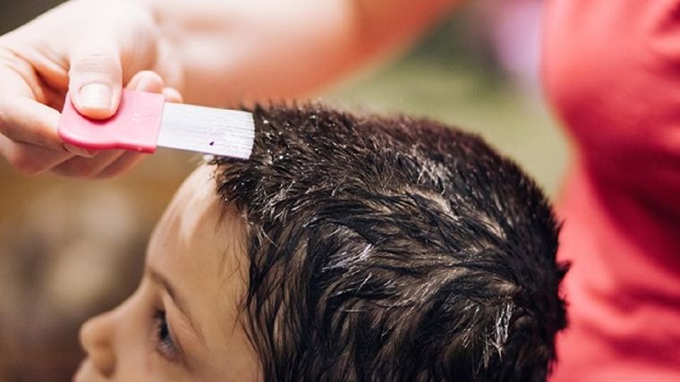 Los piojos pueden convertirse en un grave problema. Foto: iStock