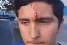 Militante libertario agredido en La Plata Foto: Captura de video