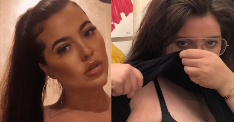 La joven tuvo que someterse a una cirugía