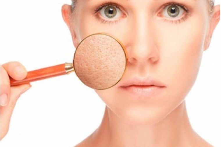 Tips de belleza para reducir los poros abiertos ¡Cambia por completo la apariencia de tu rostro!
