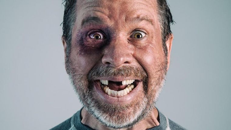 De no creer: ¿Qué significa soñar que se me caen los dientes? Los sueños son experiencias mentales y emocionales que ocurren durante el sueño. Estos pueden ser confusos y abstractos o vívidos y realistas. Foto: Archivo