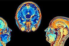 Los cambios se registraron en las zonas vinculadas al olfato y la memoria. Foto: UK BIOBANK