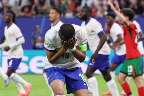 Mbappé comenzará un tratamiento consevador para llegar bien a la Copa del Mundo. Foto: EFE Mbappé comenzará un tratamiento consevador para llegar bien a la Copa del Mundo. Foto: EFE