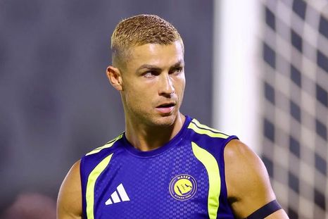 Cristiano Ronaldo quedó expuesto en el último partido del Al Nassr. Cristiano Ronaldo quedó expuesto en el último partido del Al Nassr.