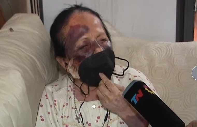 Jubilada golpeada durante un asalto Foto: archivo/imagen ilustrativa