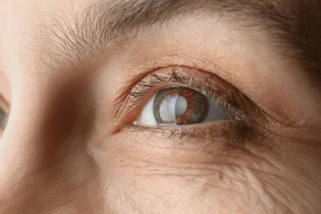 ¿Qué alimentos nos ayudan a la vista? (Shutterstock)