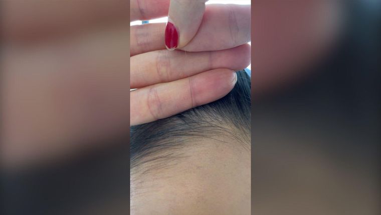 Maria Marlowe dice que su nuevo crecimiento de cabello fue más oscuro después de tomar suplementos por la deficiencia de minerales.