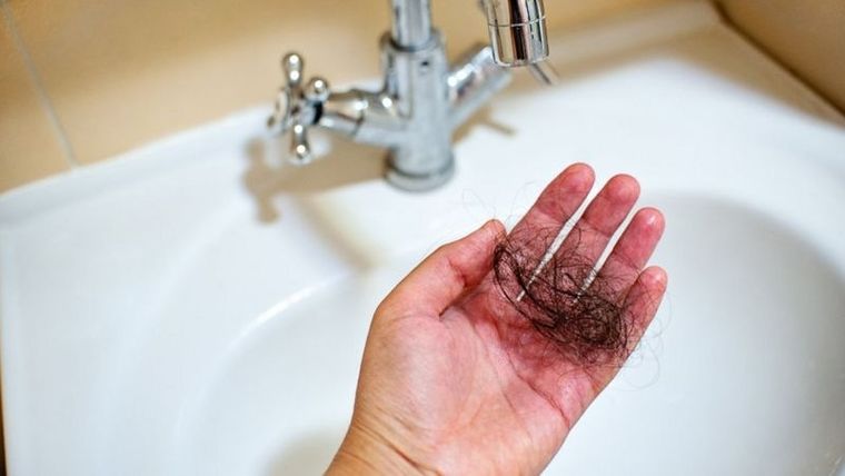 Una caída... ¡de pelo! Una caída... ¡de pelo!