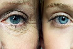 Este remedio casero es clave para rejuvenecer la piel Foto: Archivo