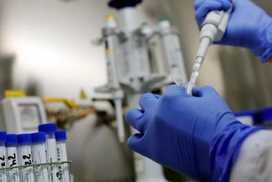 MDZol | Los genes influyen en diferentes características, y si están alterados de alguna manera, pueden provocar ciertas patologías. Foto: MDZ