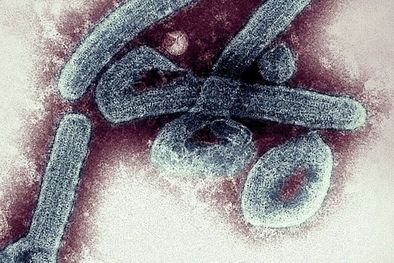 MDZol | El virus de Marburgo se detectó por primera vez en la ciudad de Marburgo, en Alemania, en 1967. Foto: GETTY IMAGES