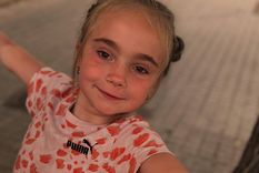 la ultima cirugia de juanita: la nina mendocina sera operada este lunes en espana