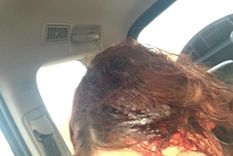 Así quedó la joven agredida con el elemento cortante.