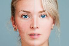 Foto: Canales MAPFRE