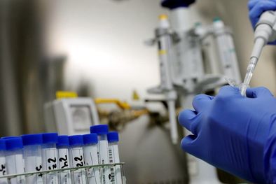 MDZol | Los test genéticos no son solo el futuro de la medicina, sino una realidad que ya está transformando vidas. Foto: Efe.