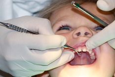 La fluoración del agua ha tenido un impacto particularmente visible en la salud dental de los niños en zonas con dificultad de acceso a crema de dientes con flúor.
