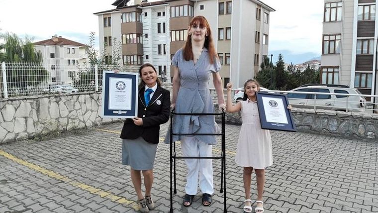 Foto: GUINNESS WORLD RECORDS / PA. Rumeysa Gelgi mide 2,15 metros.